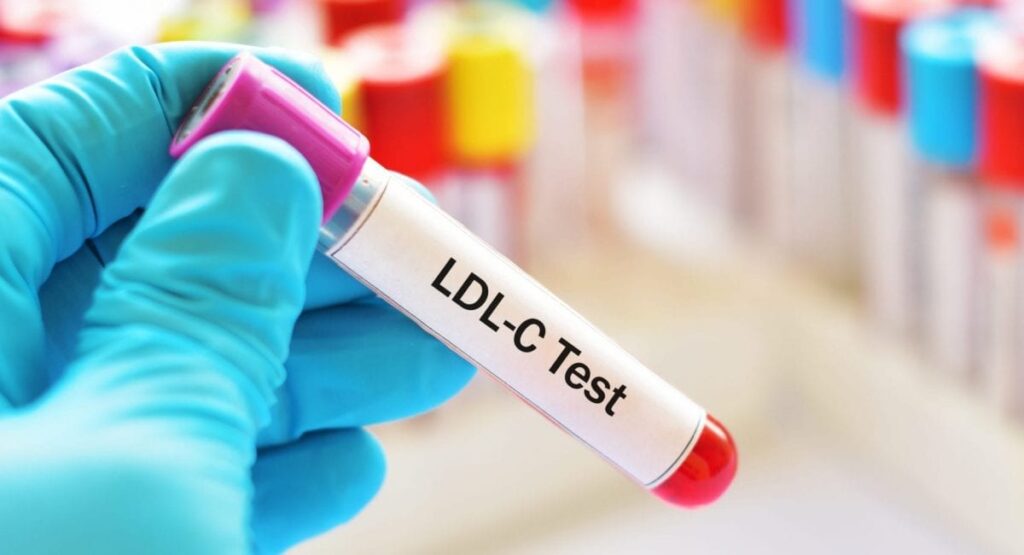 LDL-C Test blood vial.