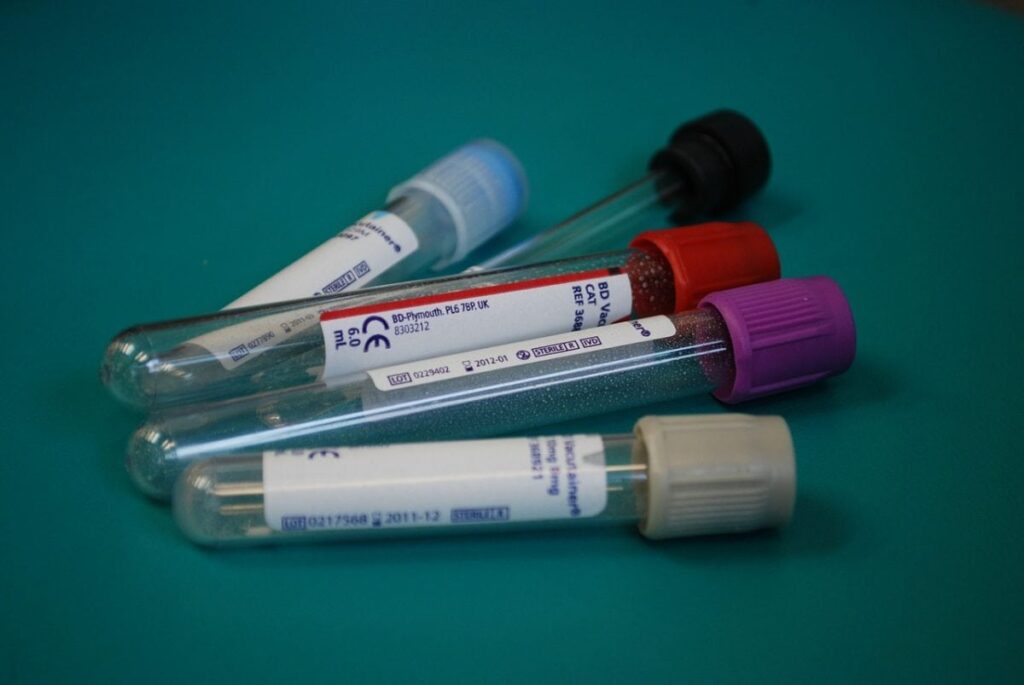 Various labeled blood vials